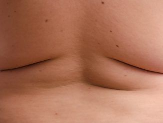 Para mantener a raya la obesidad, el color de los michelines importa