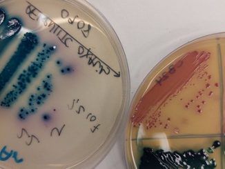 La carrera científica contra las bacterias multirresistentes
